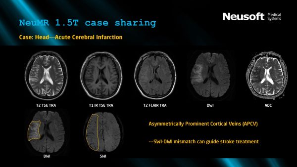 MRI Machine NeuMR 1.5T - Image 2