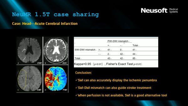 MRI Machine NeuMR 1.5T - Image 3